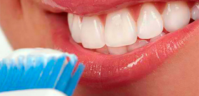 Bleaching-Zahnpasten: Wie wählt man das Beste aus und schadet dem Zahnschmelz nicht?
