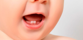 About milk (temporary) bite, as well as teething and changing teeth in children