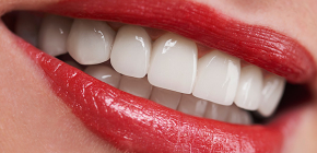 Is there non-invasive dental implantation performed without cutting the gums?