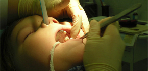 Extracción de dientes con el uso de anestesia 