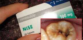 Uso de tabletas Nise para el alivio del dolor de dientes