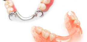 Avtagbara proteser med partiell avsaknad av tänder: vilka är bättre?