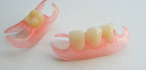 Papillons de prothèses dentaires et nuances importantes de prothèses avec leur aide