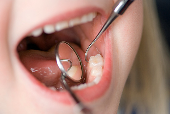 According to the severity of caries and its compensated children are divided into three groups ...