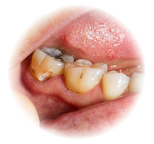 Theo hầu hết các cuốn sách mơ ước, hình ảnh của răng bị bệnh thường không tốt.