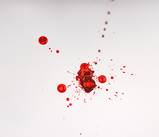 الدم من الفم يمكن أن يرمز إلى تسرب الحيوية ...
