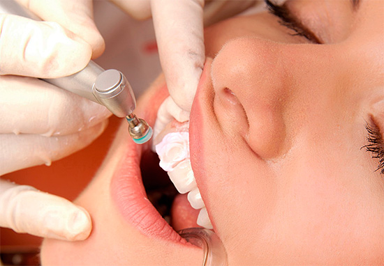 Das Verfahren der professionellen Hygiene ist sehr nützlich zum Schutz gegen Karies, wenn Plaque und Mineralablagerungen von den Zähnen entfernt werden.