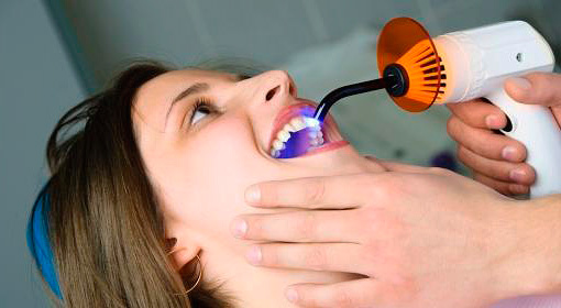 Trong các phòng khám hiện đại trong điều trị sâu răng thường sử dụng vật liệu làm đầy ánh sáng.