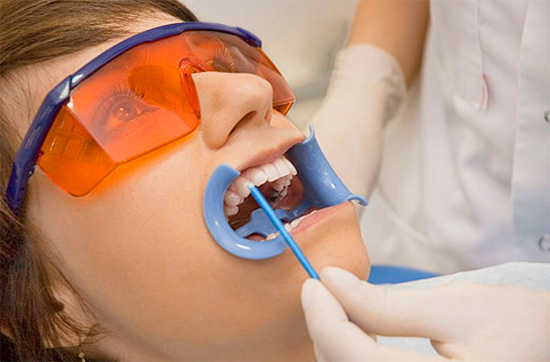 Курсът на реминерализационната терапия обикновено завършва чрез покриване на зъбите със специален флуоресцентен материал.