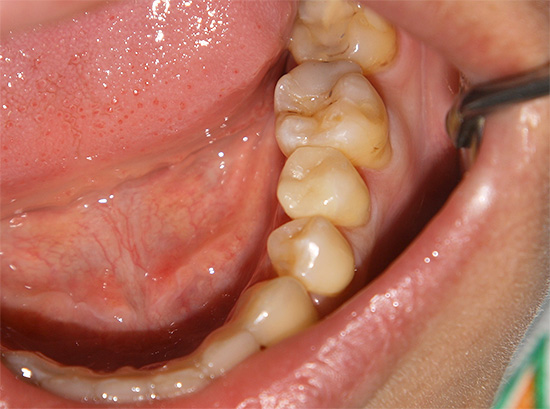يتم تحديد اختيار أفضل نسخة من العجينة إلى حد كبير من خلال الوضع المولِّد في الفم لشخص معين.