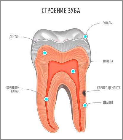 Dans le cabinet dentaire, les caries de ciment sont assez rares, mais cette pathologie est très insidieuse et, si elle n'est pas traitée, peut facilement entraîner une perte de dents ...