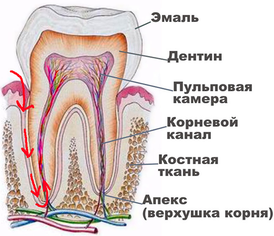 In het geval van retrograde pulpitis dringt de infectie in de tand, niet door de carieuze holte, maar door de top van de wortel.
