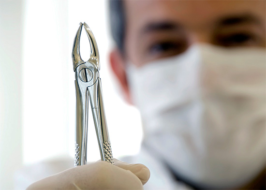 एक बुद्धि दांत से बाहर खींचने के साथ, केवल दंत pliers या एक लिफ्ट का उपयोग किया जाता है।