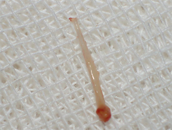Photographie de pulpe extraite d'une dent