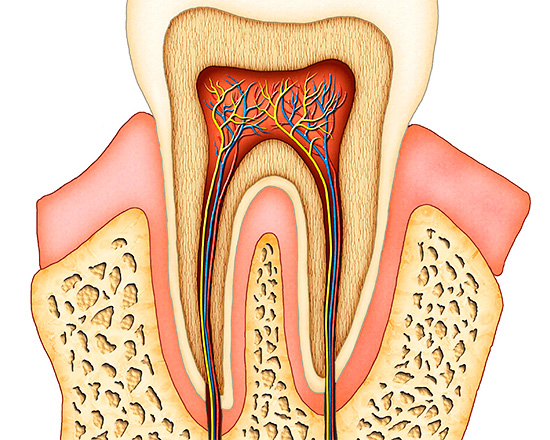 Συχνά, μπορεί να εμφανιστεί πόνος λόγω φλεγμονωδών διεργασιών στον οδοντικό πολτό.