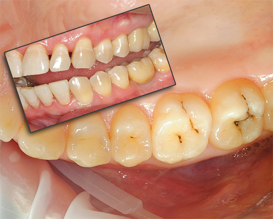 Les dents peuvent faire mal pour diverses raisons, puis nous tenterons de déterminer ce qu'il faut faire dans une situation donnée pour atténuer les souffrances.