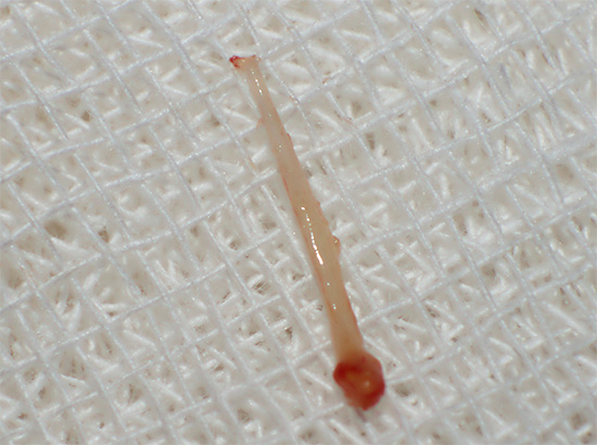 Otra fotografía de la pulpa dental: en el tratamiento de la pulpitis de un diente de tres canales, es necesario extraer un nervio de cada canal.