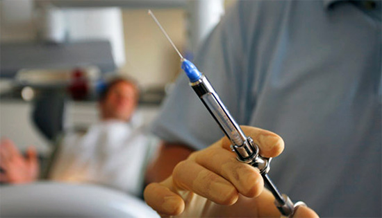 В повечето случаи локалната анестезия е достатъчна за обезболяващо отстраняване на нервите.