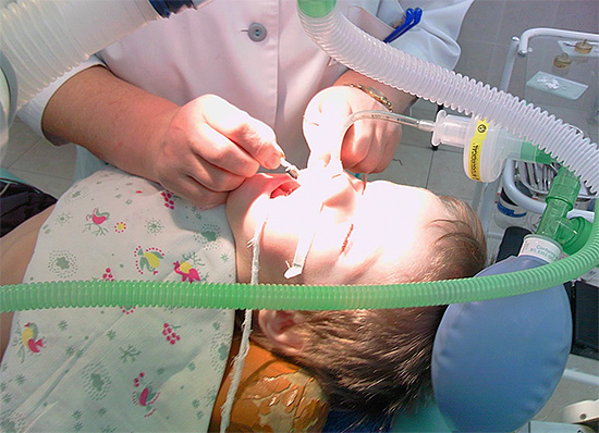 Дихателната тръба и други елементи на оборудването понякога пречат на манипулациите на лекаря в устната кухина на пациента.