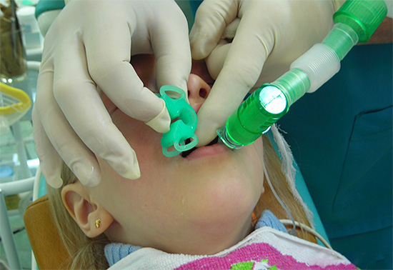 إذا كان الطفل خائفًا جدًا من علاج الأسنان ، فقد يكون استخدام التخدير العام هو الطريقة الوحيدة لتوفير رعاية الأسنان العادية.