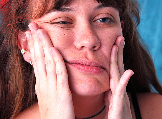 En casos raros, al extraer las muelas del juicio inferiores, se daña el nervio mandibular, lo que puede provocar una pérdida parcial de sensibilidad en diversas partes de la cara, labios, barbilla ...