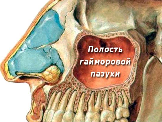 Esta imagen muestra claramente qué tan cerca están las raíces de los dientes en la mandíbula superior al seno maxilar.
