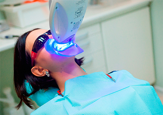 La tecnología de foto-blanqueamiento de dientes implica la activación de un gel blanqueador con la luz de una lámpara especial (por ejemplo, ultravioleta).