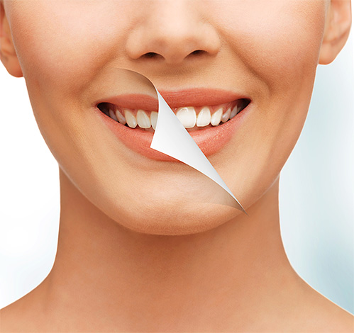Cómo blanquear de forma segura los dientes con un mínimo de efectos nocivos sobre el esmalte y, en general, es posible. Intentaremos comprender este tema con más detalle ...