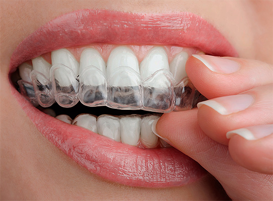Para blanquear el esmalte dental en casa, también se utiliza con un gel especial enjuague bucal.