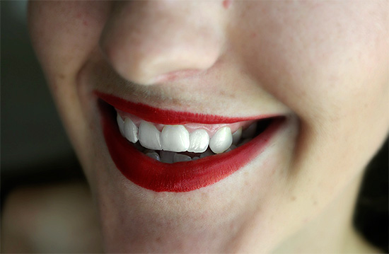 Si pintas tus labios con un lápiz labial rojo brillante, entonces los dientes en su fondo se verán más blancos ...
