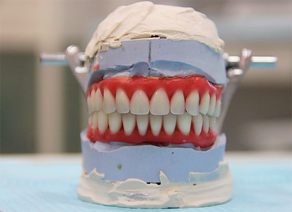 Bei signifikanter Knochengewebeatrophie werden Prothesen verwendet, deren Basis dem Zahnfleisch nachempfunden ist - so lässt sich das Ergebnis der Prothetik so ästhetisch wie möglich gestalten.