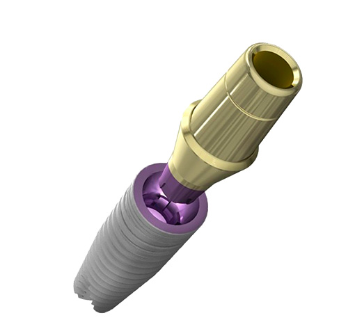 Exemple de joint de pilier et d'implant coniques