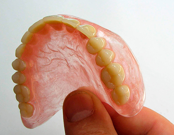 Una prótesis removible completa es una alternativa a la implantación dental, pero está lejos de ser la más placentera.