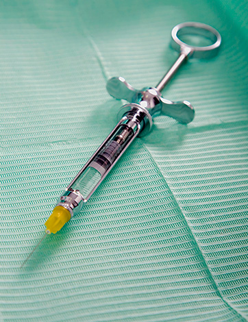 Por lo general, el procedimiento de implantación se realiza bajo anestesia local y el paciente no siente ningún dolor.