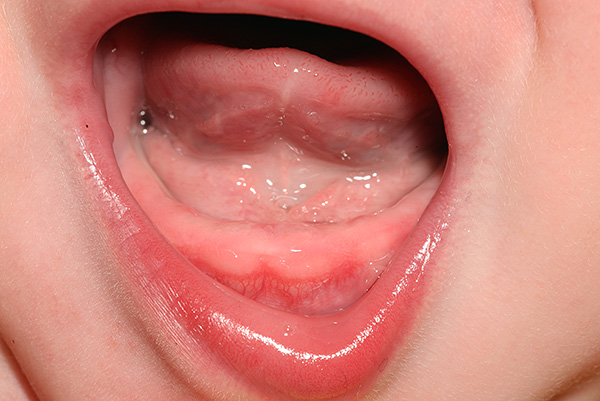 Hay situaciones en que los dientes de leche en un niño no hacen erupción durante mucho tiempo.