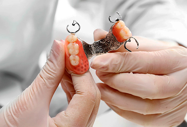Hãy nói về các sắc thái của việc sử dụng hàm răng giả clasp trong răng giả trên hàm trên ...
