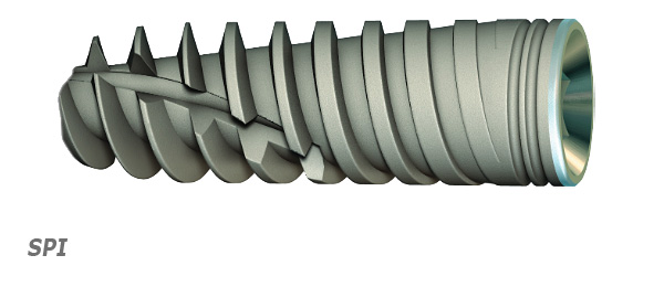 Implante SPI (Espiral)
