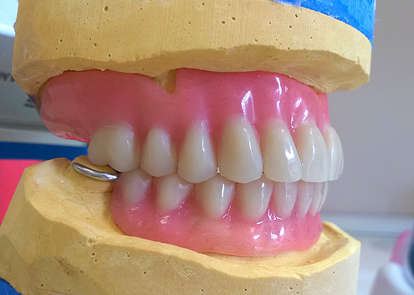 Arată o proteză acrilică finalizată pe un model de tencuială a maxilarului.