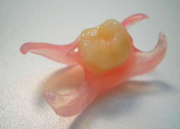 Y este es un diente masticador protésico.