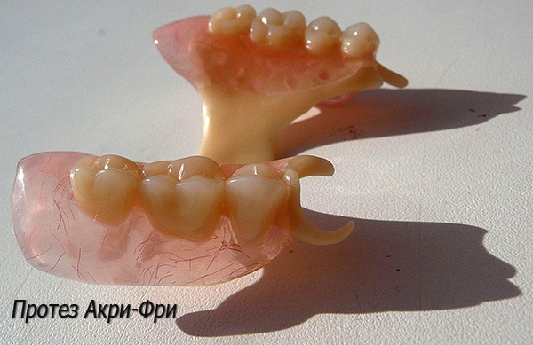 المشابك البلاستيكية لأطقم أكري فري هي أقل وضوحا في تجويف الفم أكثر من المعادن.