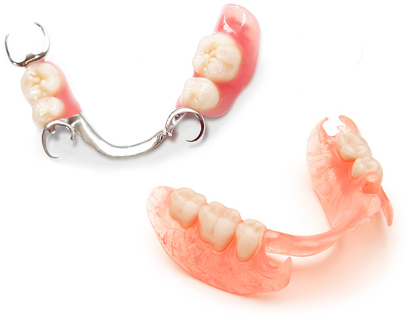 Veamos qué dentaduras postizas son mejores para usar con ausencia parcial de dientes en la cavidad oral ...