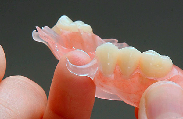 Los ganchos de nylon suave no pueden sostener la estructura de forma segura en la boca.