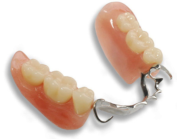En muchos casos clínicos, el uso de una prótesis de broche es la mejor opción para las prótesis de dientes perdidos.