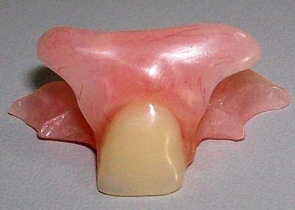 Dentadura anterior diente anterior