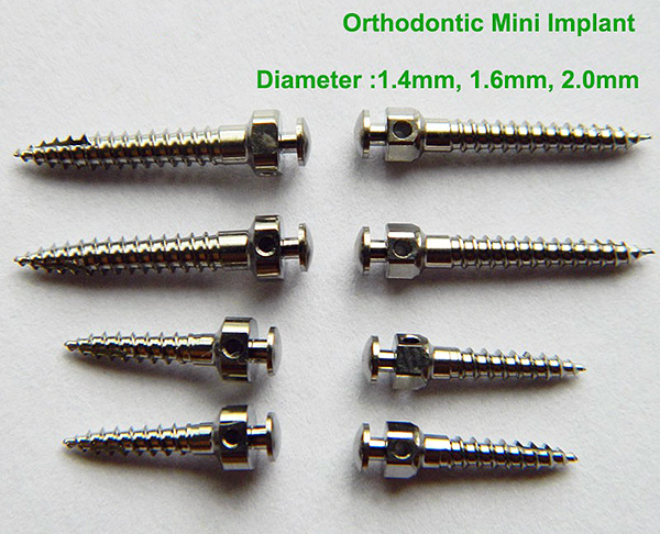 Mini implantes