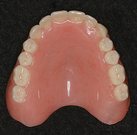 Las prótesis rígidas de plástico acrílico hoy en día siguen siendo la opción más barata para prótesis sin dientes en la boca.