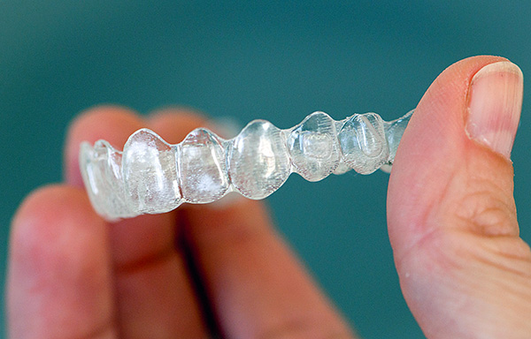 Οι οδοντιατρικές κλινικές σήμερα συχνά τοποθετούν τέτοια καλύμματα ως πλήρη αντικατάσταση των στηριγμάτων.
