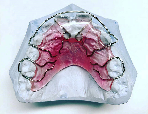 Mit diesem Gerät können Sie die Position der Zähne im Oberkiefer effektiv einstellen.