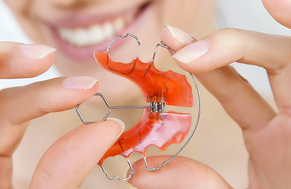 Анатомичните ортодонтски уреди имат винт, който позволява разширяване на челюстта.