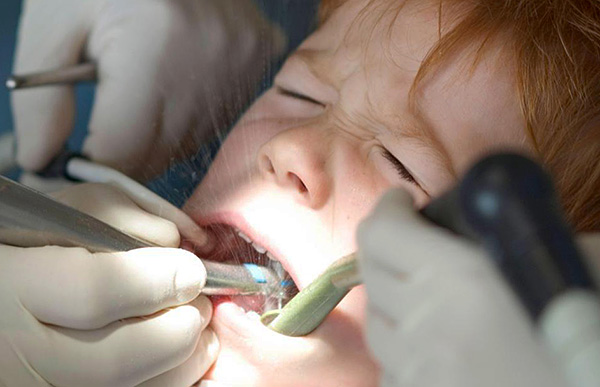 Il faut comprendre que la cause de douleurs à long terme dans la dent peut bien être une erreur médicale commise par le dentiste lors du traitement d'une pulpite.